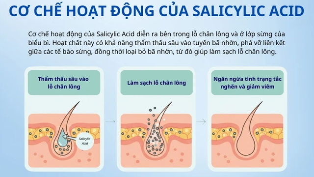 Salicylic acid là gì mà chuyên gia da liễu luôn khuyên dùng cho da dầu mụn? - Ảnh 3.