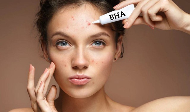 Salicylic acid là gì mà chuyên gia da liễu luôn khuyên dùng cho da dầu mụn? - Ảnh 8.