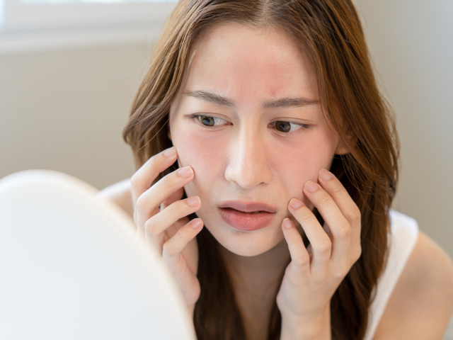 Chuyên gia chỉ ra loại kem chống nắng khiến da xuống cấp mà nhiều người vẫn dùng- Ảnh 2.