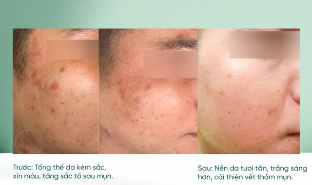 Vitamin C là gì mà ai cũng tìm mua nếu muốn sở hữu làn da không tuổi? - Ảnh 11.