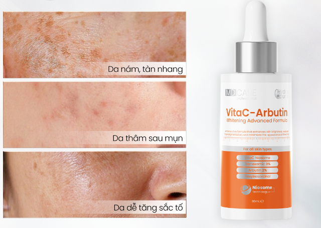 Vitamin C là gì mà ai cũng tìm mua nếu muốn sở hữu làn da không tuổi? - Ảnh 12.