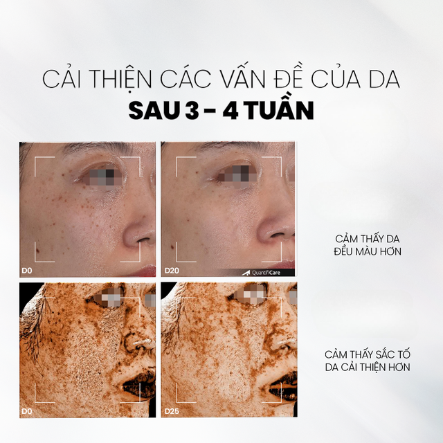 Vitamin C là gì mà ai cũng tìm mua nếu muốn sở hữu làn da không tuổi? - Ảnh 13.
