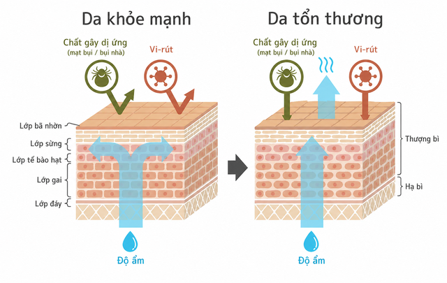 Vì sao da bạn ngày càng nhạy cảm dù đã chăm sóc kỹ hơn bao giờ hết? - Ảnh 3.