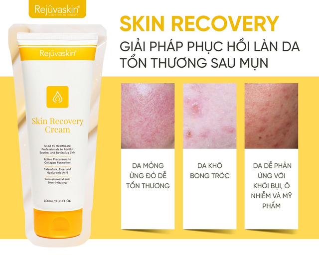 Phục hồi hàng rào bảo vệ da: bước bị bỏ quên khi da càng chăm càng tệ- Ảnh 4.
