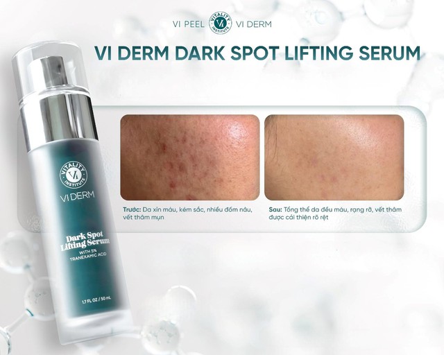 Top 6 serum dưỡng da giúp mờ cả nám sạm đậm màu, kể cả nám chân sâu - Ảnh 4.