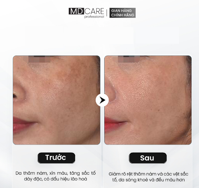 Top 6 serum dưỡng da giúp mờ cả nám sạm đậm màu, kể cả nám chân sâu - Ảnh 9.