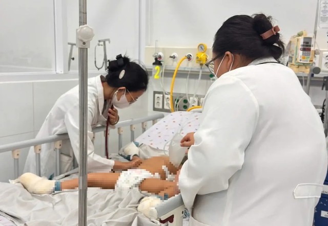 Hai anh em ruột bị bỏng trong vụ cháy xe khách ở Đồng Nai chuyển lên TP.HCM - Ảnh 2.