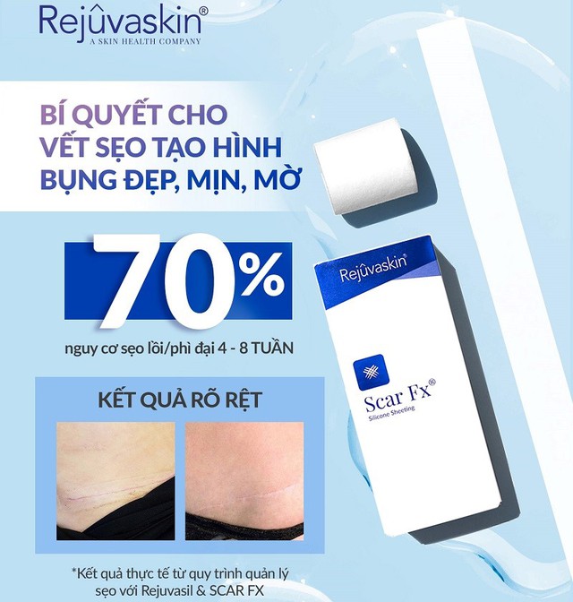 Review miếng d&aacute;n sẹo lồi Scar FX hiệu quả với cả sẹo l&acirc;u năm kh&ocirc;ng x&acirc;m lấn? - Ảnh 3.