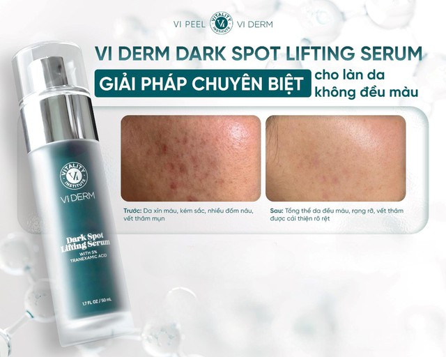 Top 7 kem mờ n&aacute;m ch&acirc;n s&acirc;u gi&uacute;p da trắng hồng rạng rỡ sau khoảng 4 tuần - Ảnh 7.