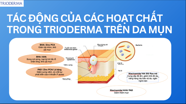 Gel chấm mụn nên dùng khi nào? Những lưu ý trước khi chấm mụn - Ảnh 5.
