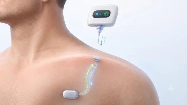 C&aacute;c nh&agrave; khoa học thử nghiệm "ổ cắm USB" cho cơ thể người - Ảnh 1.
