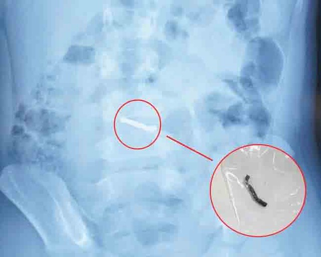 Cẩn trọng với đồ chơi có nam châm cho trẻ nhỏ - Ảnh 1.