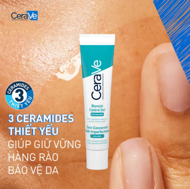 Top 4 kem chấm mụn &lsquo;dập ổ mụn hiệu quả&rsquo; s&aacute;ng dậy xẹp mụn kh&ocirc;ng lo sẹo - Ảnh 4.