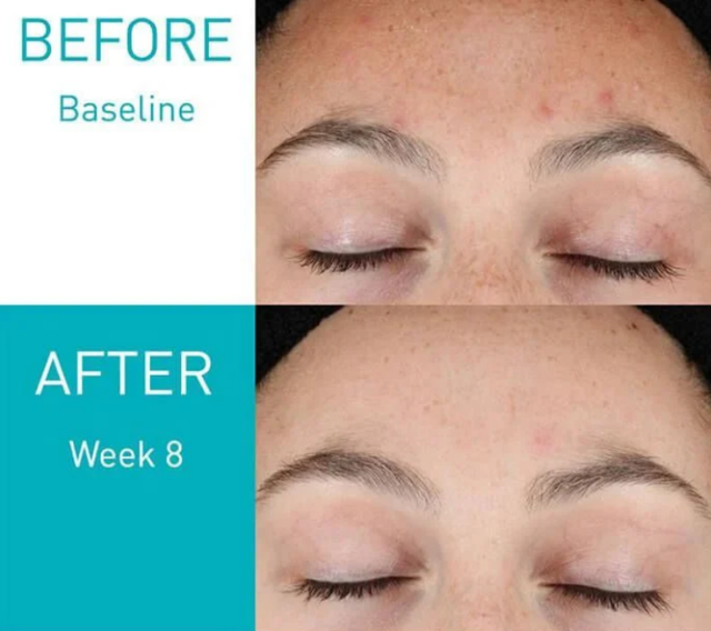 +5 &lsquo;kem Retinol 4.0&rsquo; tăng sinh collagen gi&uacute;p mờ n&aacute;m sạm da căng b&oacute;ng, tươi trẻ hơn - Ảnh 11.