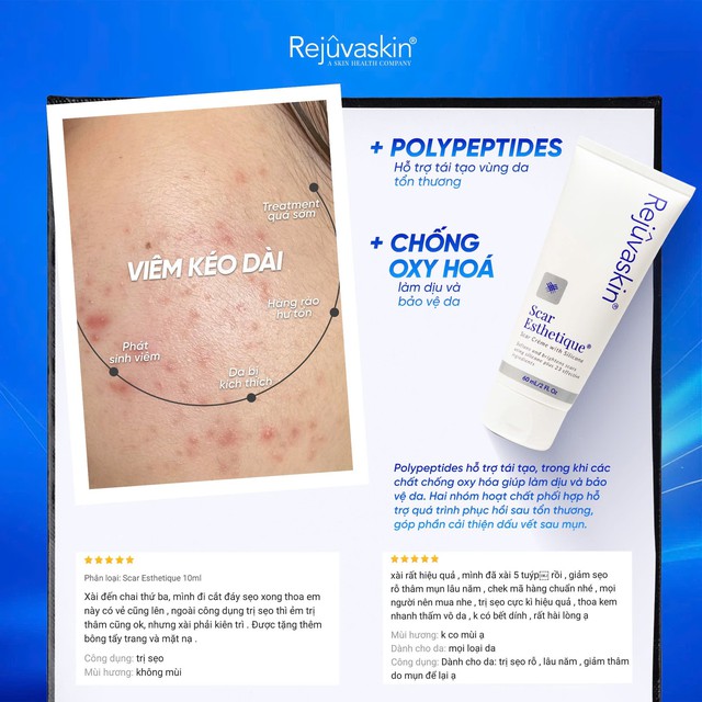 Review kem mờ sẹo th&acirc;m mụn Scar Esthetique tốt kh&ocirc;ng m&agrave; lu&ocirc;n lọt top đầu b&aacute;n chạy? - Ảnh 4.