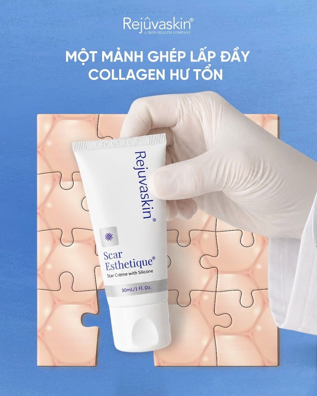 Review kem mờ sẹo th&acirc;m mụn Scar Esthetique tốt kh&ocirc;ng m&agrave; lu&ocirc;n lọt top đầu b&aacute;n chạy? - Ảnh 9.