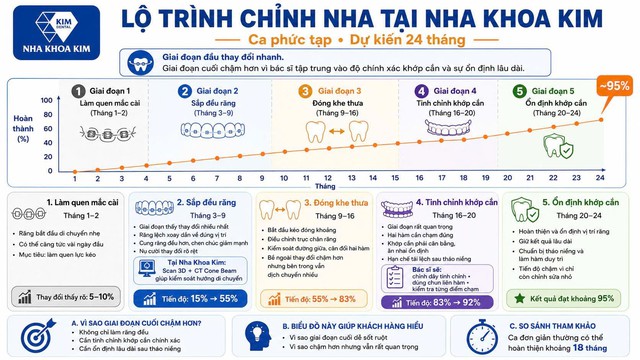 Nha Khoa Kim ti&ecirc;n phong chuẩn h&oacute;a quy tr&igrave;nh niềng răng đẹp đ&uacute;ng lộ tr&igrave;nh- Ảnh 1.