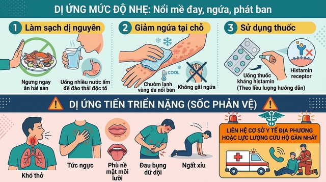 Dị ứng hay ngộ độc hải sản? Bác sĩ chỉ dấu hiệu phân biệt - Ảnh 2.