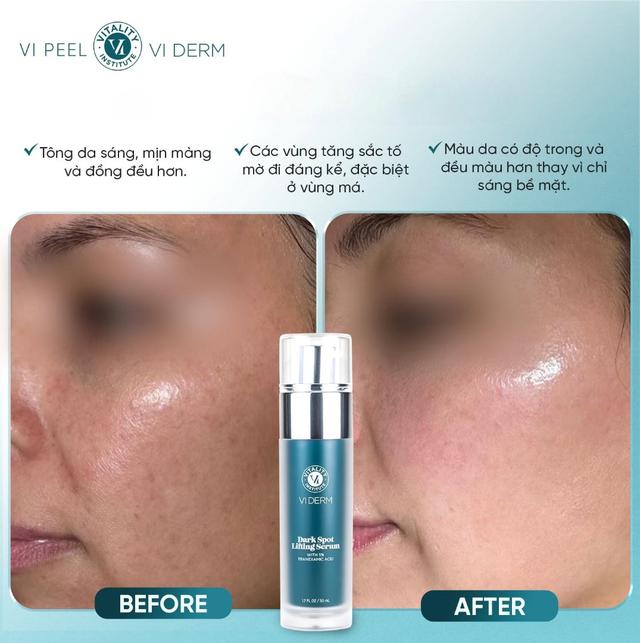 +5 serum mờ nám mảng loang lổ khắp mặt cũng cải thiện, da bật tone trắng hồng- Ảnh 9.