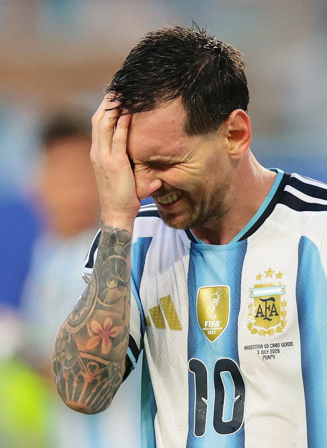 Messi sưng v&ecirc;u tr&aacute;n sau trận thắng Cabo Verde: V&igrave; sao n&ecirc;n nỗi?- Ảnh 2.