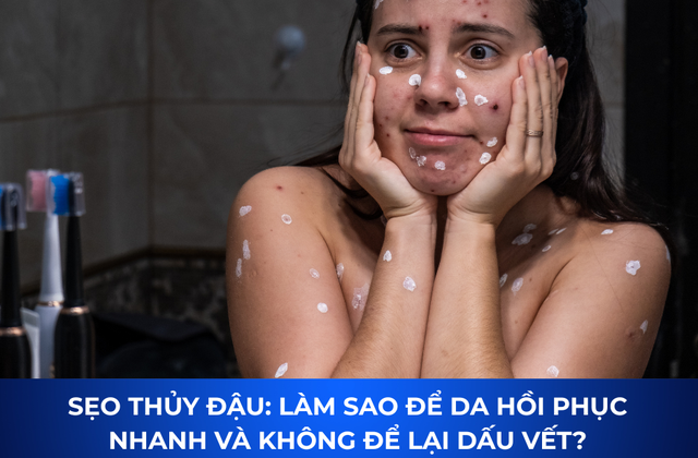 Sẹo thủy đậu c&oacute; tự hết kh&ocirc;ng? C&aacute;ch mờ sẹo sau 4 tuần, kể cả l&acirc;u năm - Ảnh 1.