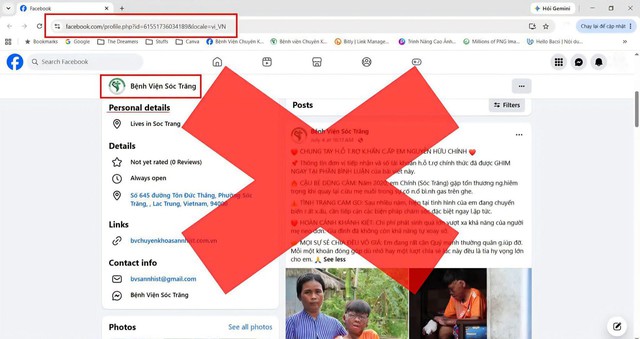 Tài khoản Facebook giả mạo, đăng hình cậu bé bị bỏng 96% để kêu gọi từ thiện- Ảnh 1.