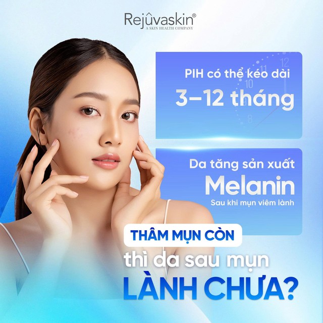 Sẹo đỏ sau mụn bao l&acirc;u th&igrave; hết? Đừng vội điều trị sai c&aacute;ch - Ảnh 1.