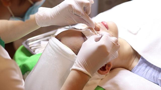 Có nên nặn mụn? Chia sẻ từ chuyên gia khiến nhiều người tiếc vì không biết sớm- Ảnh 3.