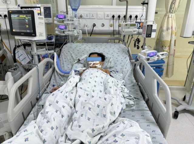 3 chị em ngộ độc v&igrave; ăn chuột đồng, một b&eacute; xuất huyết nặng phải thở m&aacute;y - Ảnh 1.