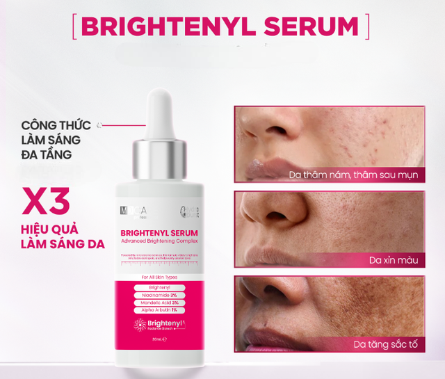 +7 kem mờ nám giúp da sau sinh vẫn trắng hồng rạng rỡ, mẹ tự tin hơn- Ảnh 5.