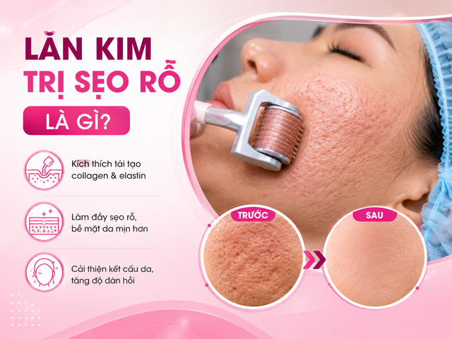 Chuyên gia bật mí cách ngừa sẹo sau lăn kim hiệu quả khiến ai cũng làm theo - Ảnh 2.