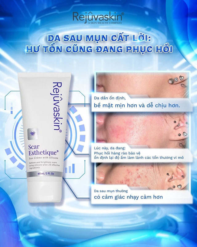Chuyên gia bật mí cách ngừa sẹo sau lăn kim hiệu quả khiến ai cũng làm theo - Ảnh 6.