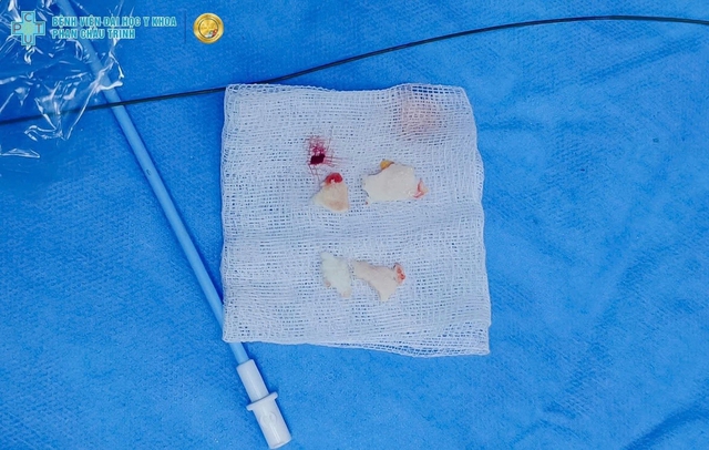 Du kh&aacute;ch đến Việt Nam t&igrave;m cơ hội bảo tồn khớp h&aacute;ng sau chấn thương phức tạp - Ảnh 2.