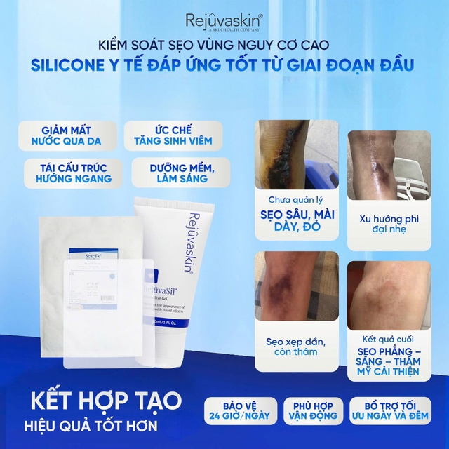 C&aacute;ch ngừa sẹo chuẩn y khoa cho l&agrave;n da phẳng mịn, ngừa sẹo kh&ocirc;ng kh&oacute; - Ảnh 6.