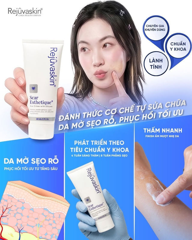 C&aacute;ch ngừa sẹo chuẩn y khoa cho l&agrave;n da phẳng mịn, ngừa sẹo kh&ocirc;ng kh&oacute; - Ảnh 9.
