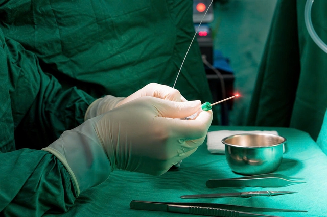 Triệt ti&ecirc;u b&uacute;i trĩ bằng c&ocirc;ng nghệ Laser Diode kh&ocirc;ng d&ugrave;ng dao mổ tại Đ&agrave; Lạt- Ảnh 3.