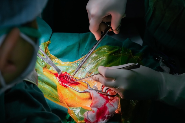 Não của người bệnh trở thành 'monitor' sống trong phẫu thuật ngừa đột quỵ- Ảnh 1.