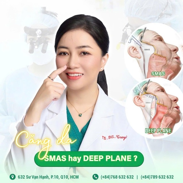 Căng da mặt Deep Plane là gì? Hiểu đúng và áp dụng hiệu quả- Ảnh 1.