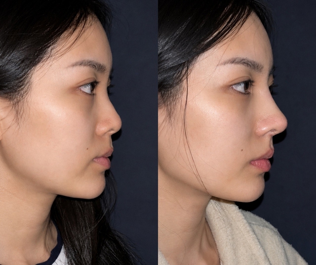 DR. HỮU - Địa chỉ phẫu thuật thẩm mỹ chuyên khoa tại Bảo Lộc, Lâm Đồng- Ảnh 4.