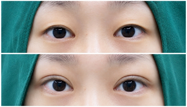 DR. HỮU - Địa chỉ phẫu thuật thẩm mỹ chuyên khoa tại Bảo Lộc, Lâm Đồng- Ảnh 5.