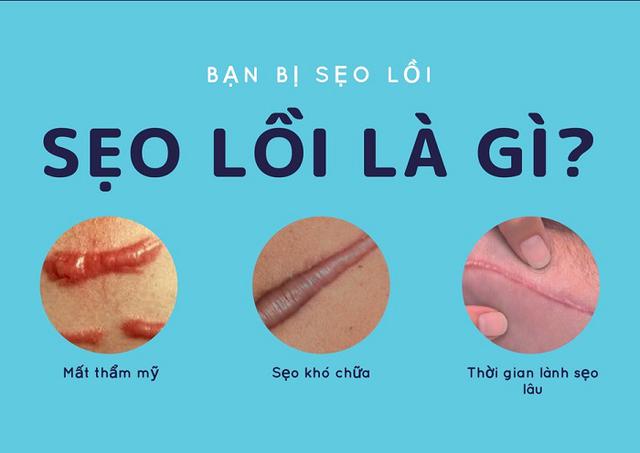 Sẹo lồi bao l&acirc;u th&igrave; hết? Chuy&ecirc;n gia da liễu trả lời khiến ai cũng bất ngờ - Ảnh 2.