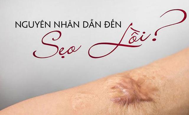 Sẹo lồi bao l&acirc;u th&igrave; hết? Chuy&ecirc;n gia da liễu trả lời khiến ai cũng bất ngờ - Ảnh 3.