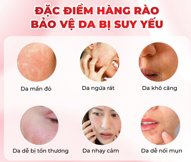 Mụn m&atilde;i kh&ocirc;ng hết, chuy&ecirc;n gia da liễu chỉ ra nguy&ecirc;n nh&acirc;n kh&ocirc;ng ai ngờ tới- Ảnh 2.