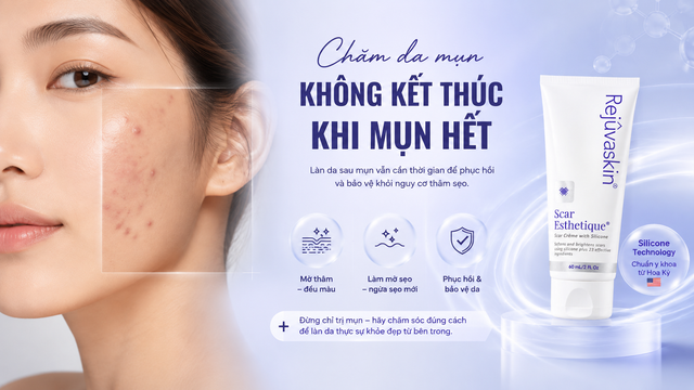 Chăm da mụn kh&ocirc;ng kết th&uacute;c khi mụn hết - Ảnh 1.