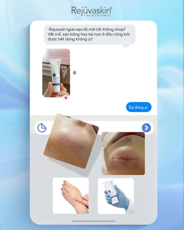 Có cách nào ngừa sẹo từ vết khâu cho da từng đụng dao kéo vẫn láng mịn?- Ảnh 11.