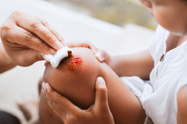 Xu hướng chăm sóc vết thương bằng sản phẩm xịt không gây xót- Ảnh 2.
