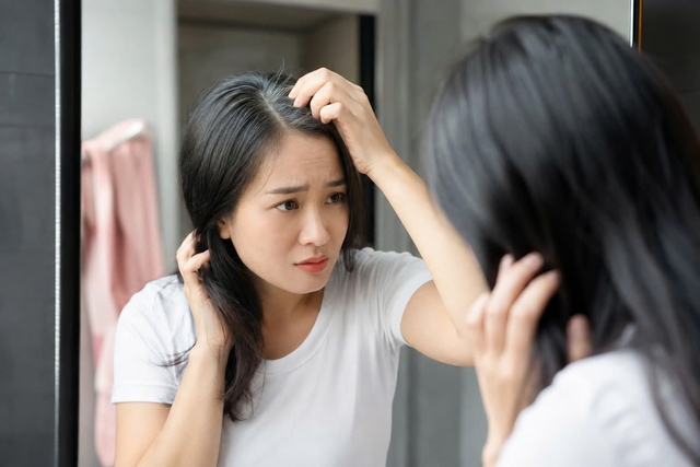 Tóc bạc trước tuổi 35: Những nguyên nhân ít ai ngờ - Ảnh 1.