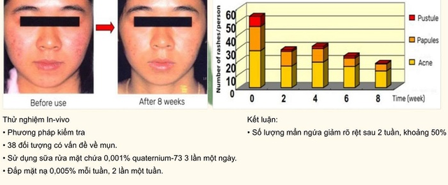 Tại sao pionin (quaternium-73) được chuyên gia nhận định là xu hướng điều trị mụn mới? - Ảnh 3.
