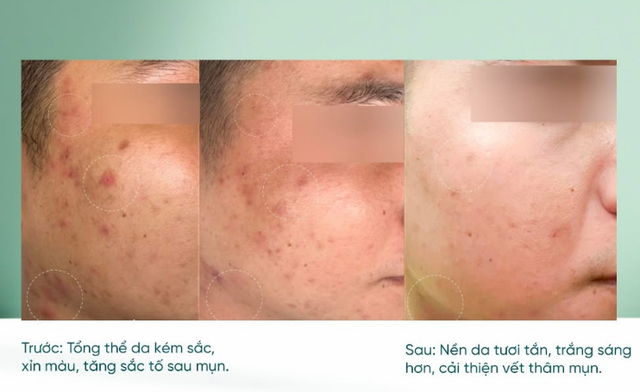 +4 serum chống lão hóa có lượt bán top đầu vì hiệu quả ‘trẻ hóa’ bất ngờ - Ảnh 7.
