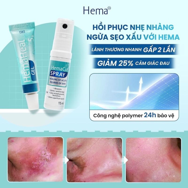HemaCut Spray và HemaHeal Gel: Linh hoạt chăm sóc theo từng loại vết thương - Ảnh 5.